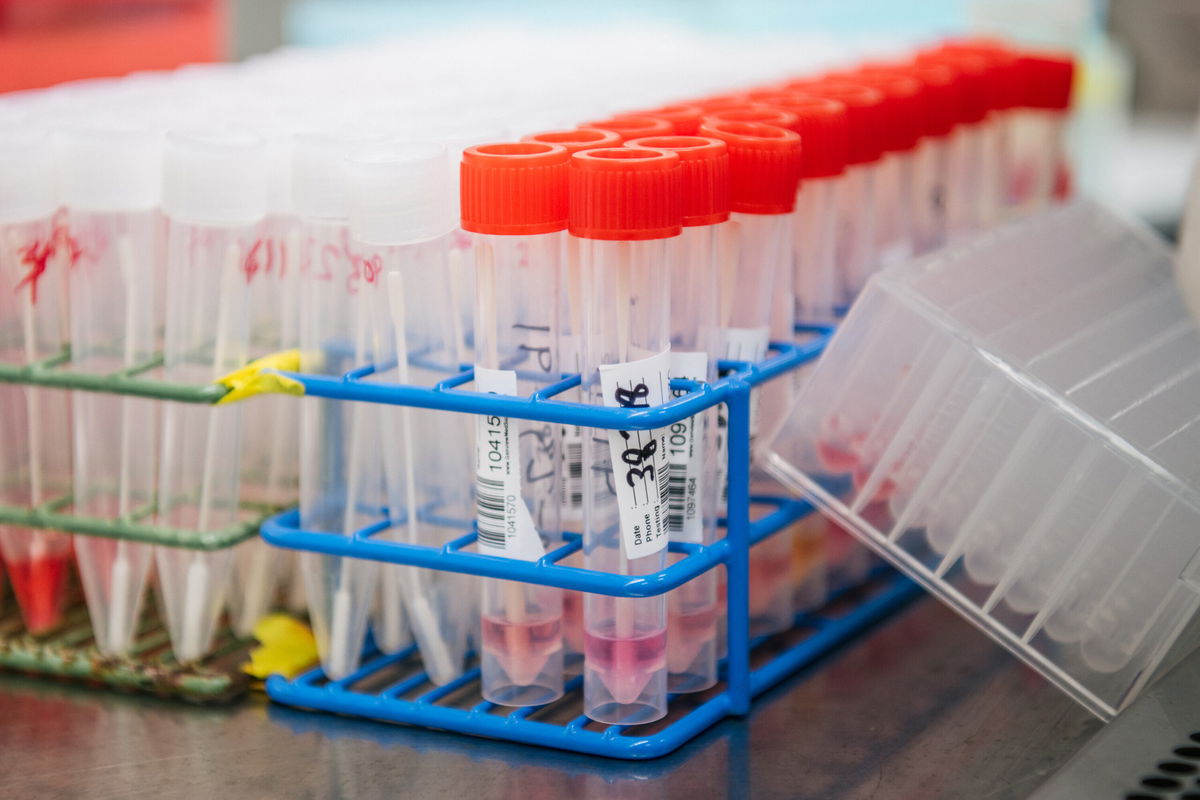 <i>Brandon Bell/Getty Images</i><br/>COVID-19 sample viles are shown during preparation for isolation and extraction at the Genview Diagnosis lab on August 13