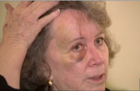 <i>KCAL</i><br/>70-year-old Christine Barry was attacked in Long Beach while helping the homeless community.