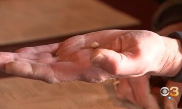 Michael Spressler holds a pearl in his hand that he says he found while eating clams on the half shell at a Cape May