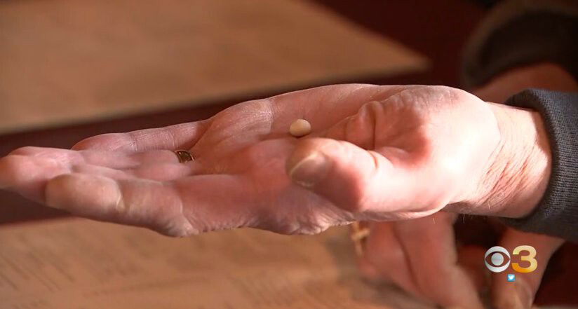 <i>KYW</i><br/>Michael Spressler holds a pearl in his hand that he says he found while eating clams on the half shell at a Cape May