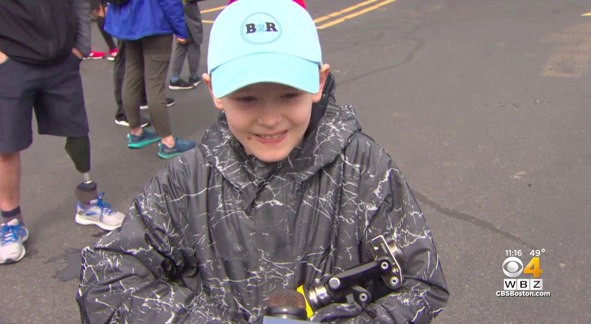 <i>WBZ</i><br/>Aiden Collyar lost his leg to cancer a year ago.