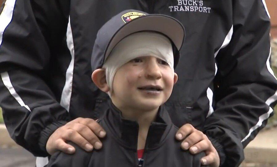 6-year-old Dominick Krankall released from hospital after being severely  burned – KION546
