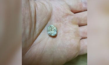 This tooth belong to a young woman who lived more than 130