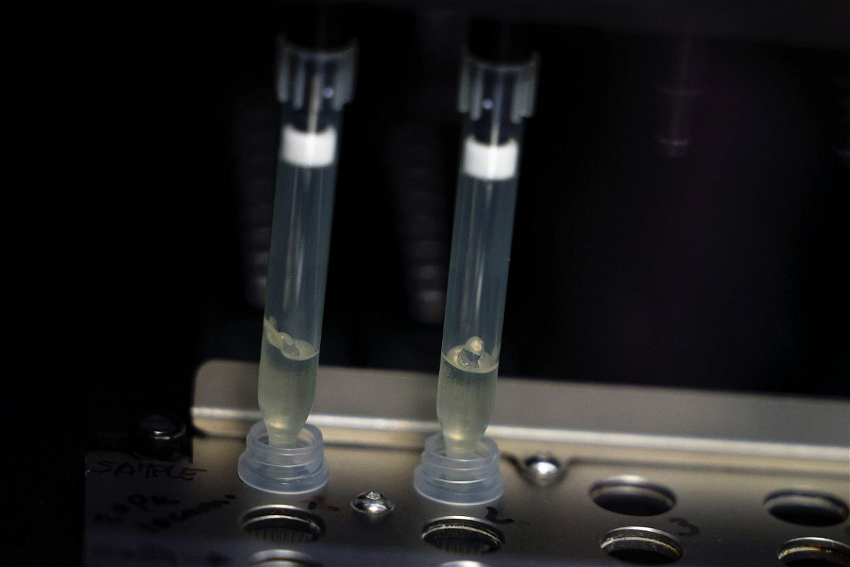 Two samples of suspected cases of monkeypox go through a process of nucleic acid extraction as they get tested at a microbiology lab at La Paz Hospital in Madrid, Spain, June 1, 2022. REUTERS/Susana Vera