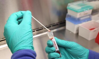 A swab that tested positive for the Monkeypox virus is seen at the UW Medicine Virology Laboratory on July 12
