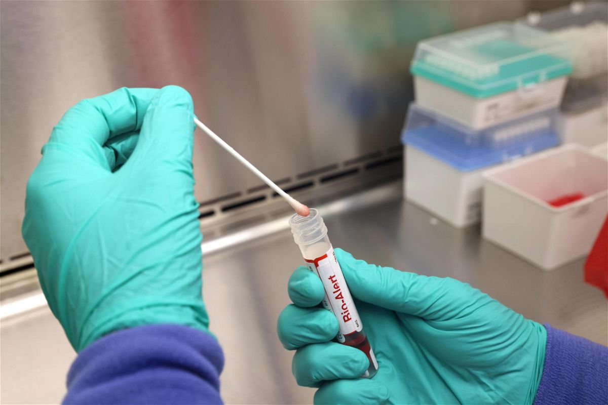 <i>Karen Ducey/Getty Images</i><br/>A swab that tested positive for the Monkeypox virus is seen at the UW Medicine Virology Laboratory on July 12