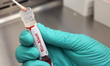 A swab that tested positive for the Monkeypox virus is seen at the UW Medicine Virology Laboratory on July 12