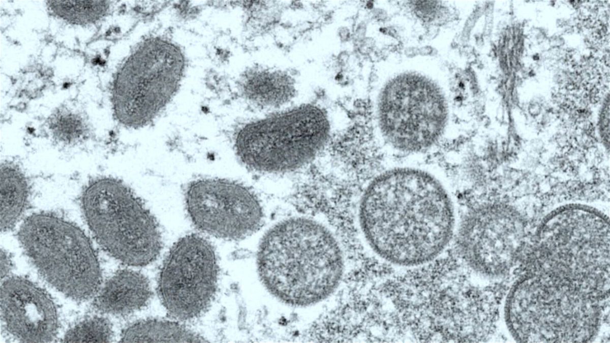 <i>CNN</i><br/>Most monkeypox cases in the current outbreak have been linked to sexual activity