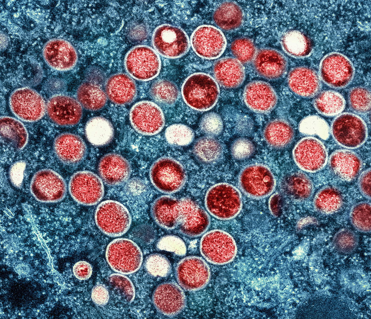 <i>NIAID/AP</i><br/>This image shows a colorized transmission electron micrograph of monkeypox particles (red). The WHO says that the first possible case of human-to-dog monkeypox transmission is 'not surprising.'