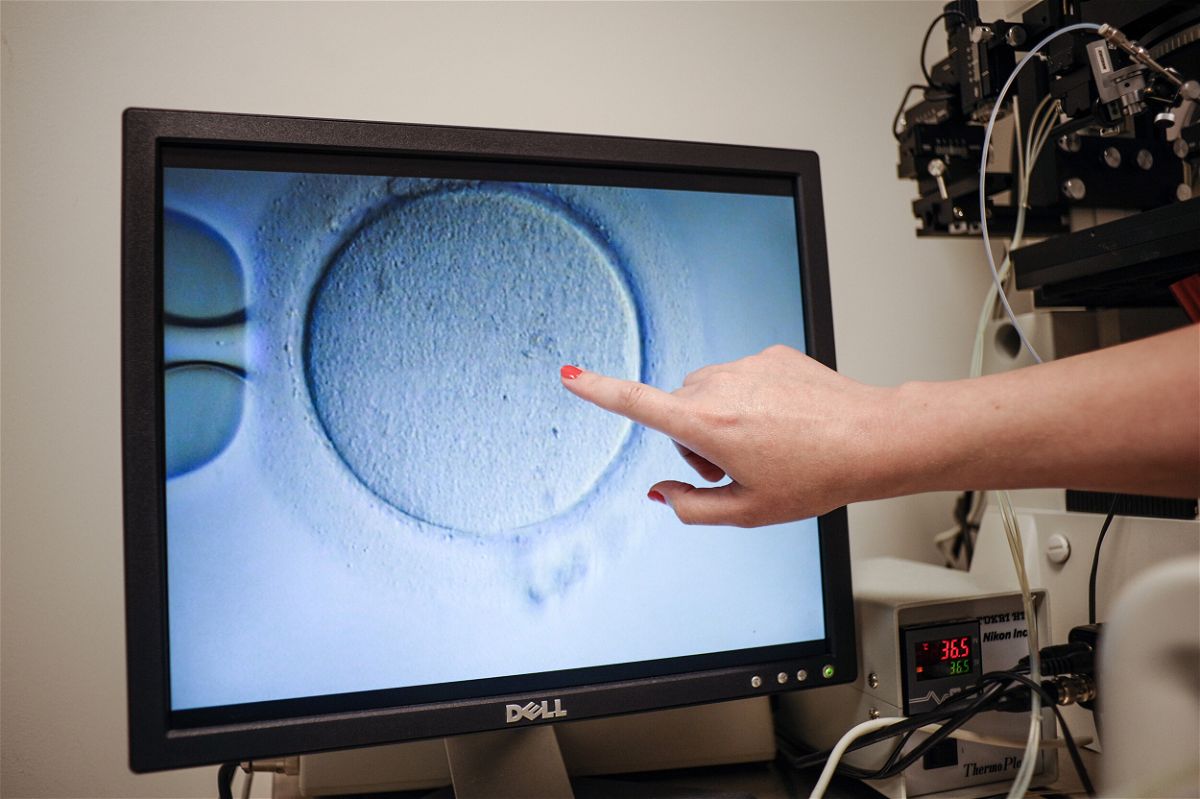 <i>Ivan Courounne/AFP/Getty Images/FILE</i><br/>An embryologist shows an Ovocyte after it was inseminated in Reston