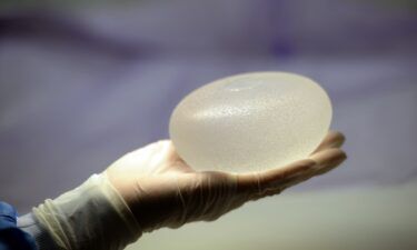 The US Food and Drug Administration is alerting the public about certain cancers -- including squamous cell carcinoma and various lymphoma -- that have been reported in the scar tissue that forms around breast implants.