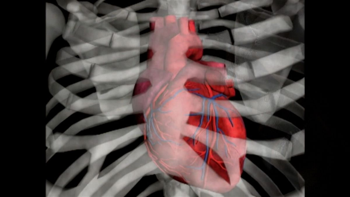 <i>CNN</i><br/>Cardiologists say an inexpensive polypill is probably one of the best ways to solve the world's heart problems.