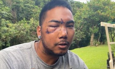 A man named Nui was beaten by a masked mob near a Waikiki party scene.