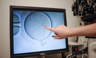 An embryologist shows an Ovocyte after it was inseminated at the Virginia Center for Reproductive Medicine