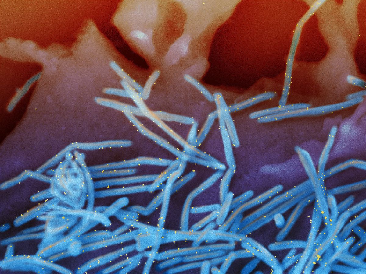 <i>NIAID</i><br/>Scanning electron micrograph of human respiratory syncytial virus. RSV is a common contagious virus that infects the human respiratory tract.