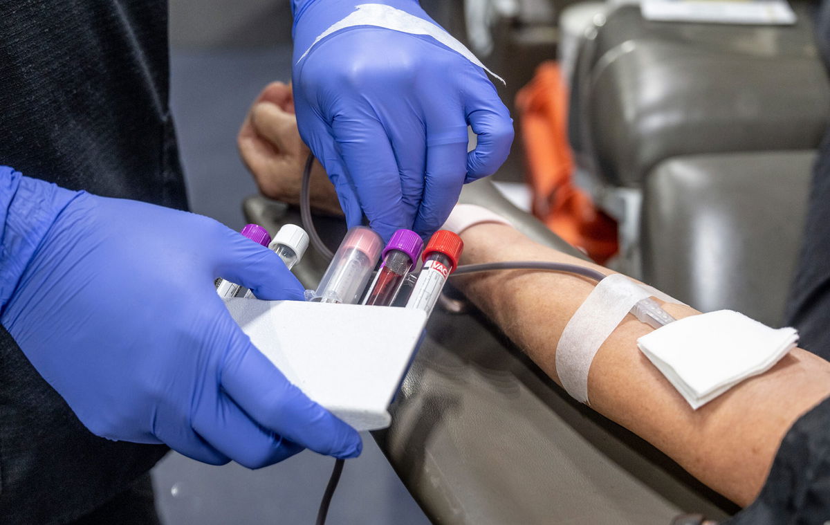 Fullerton, CA - January 20: A nurse fills test tubes with blood to be tested during an American Red Cross bloodmobile in Fullerton, CA on Thursday, January 20, 2022. The American Red Cross and hospitals are facing a critical shortage of donated blood. The American Red Cross expected to collect about 25 pints of blood during the one-day event. (Photo by Paul Bersebach/MediaNews Group/Orange County Register via Getty Images)