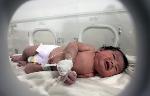 The baby girl receives treatment inside an incubator at a children's hospital in the town of Afrin