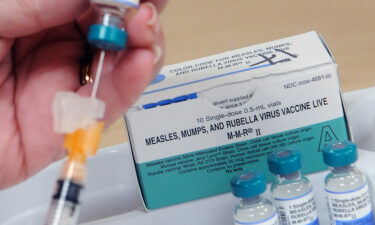 A measles outbreak in central Ohio that sickened 85 children has been declared over.