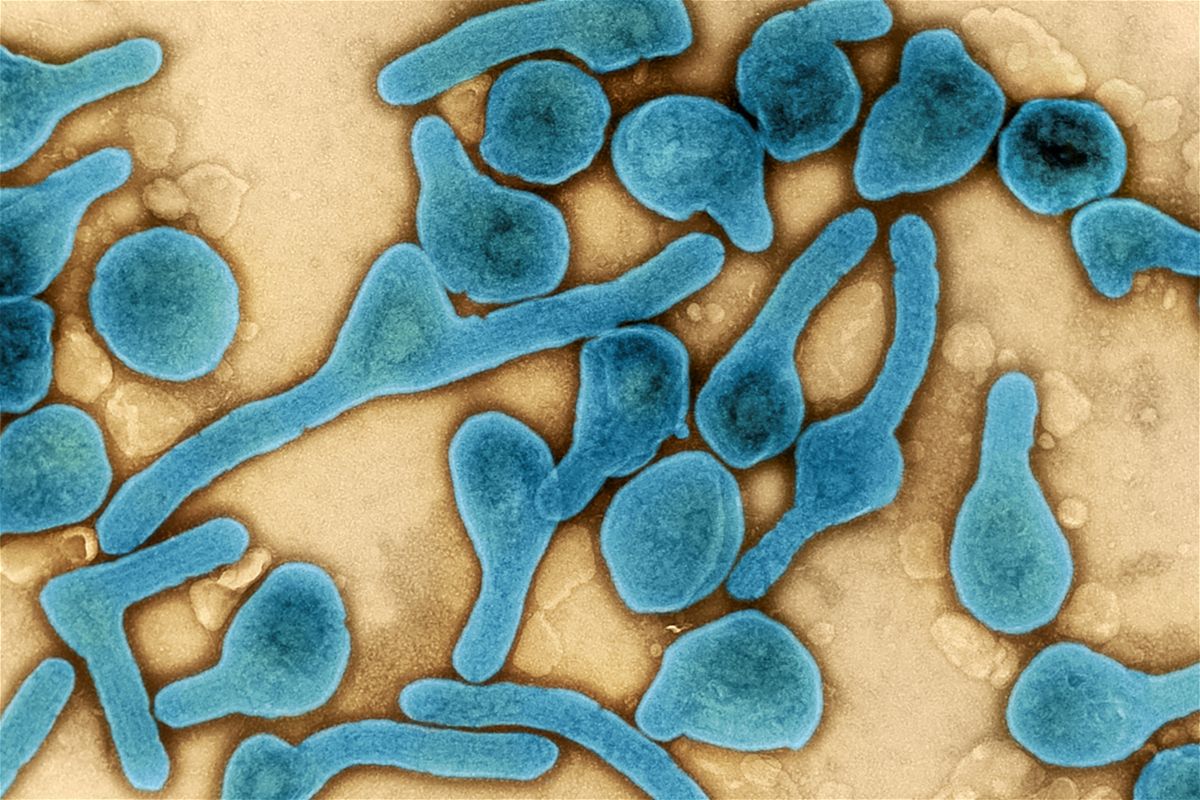 <i>NIAID</i><br/>A color-enhanced electron micrograph depicts Marburg virus particles in blue at the NIAID Integrated Research Facility in Fort Detrick