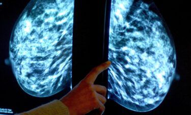 A breast cancer diagnosis is an all-too-common reality for women around the world. In the US