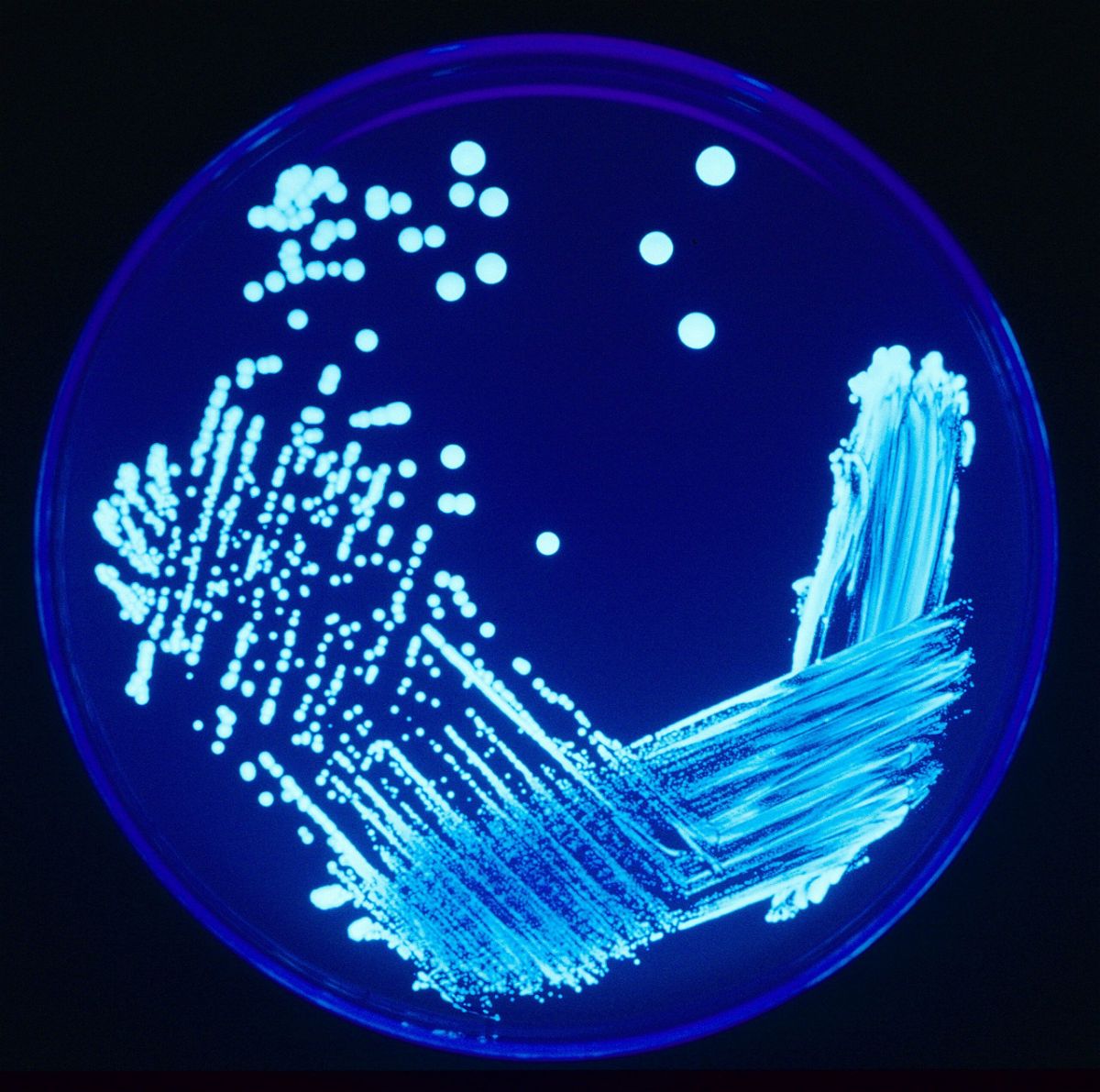 <i>Smith Collection/Gado/Archive Photos/Getty Images</i><br/>The CDC warns that instances of Legionnaires’ disease have increased “substantially” over the past decade.