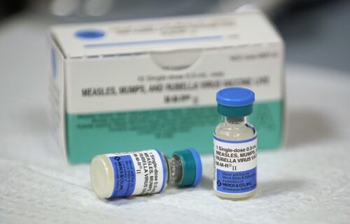 Measles is debilitating