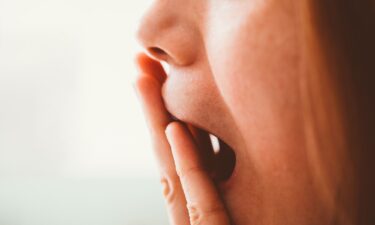 Excessive yawning and nodding off in dull work meetings at work can be serious signs of sleepiness