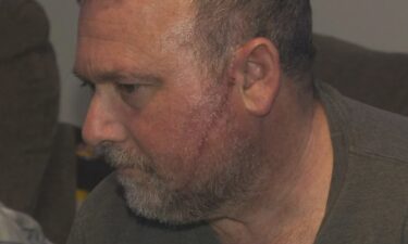 John Baglio's face was slashed by a total stranger who pounced on him as he and his wife took a break outside the hospital while his son was being treated for an emergency heart condition inside
