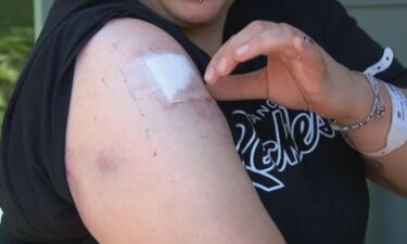 A Colorado mom is worried and angry after she was struck by a stray bullet while inside her home in Aurora.