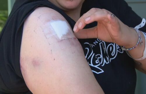 A Colorado mom is worried and angry after she was struck by a stray bullet while inside her home in Aurora.