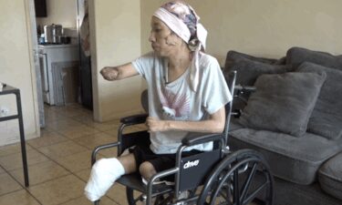 Arisbeth Munoz is now home after a harrowing battle with necrotizing fasciitis that led to multiple amputations.
